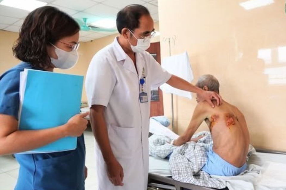 Warning About Dangerous Complications Caused by Shingles
